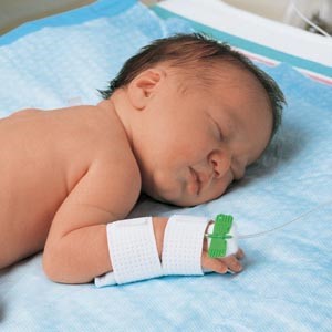 hand showing extensor tendons